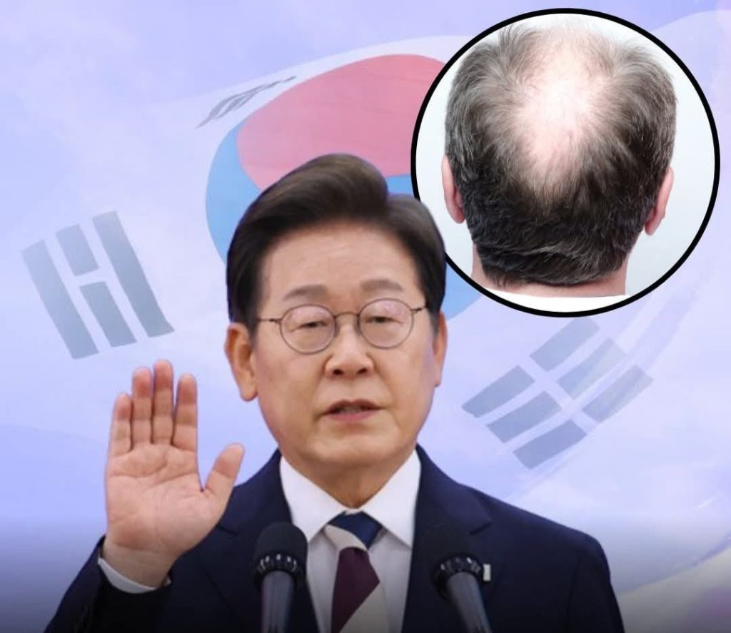 Llegaría el fin de los calvos en Corea del Sur.